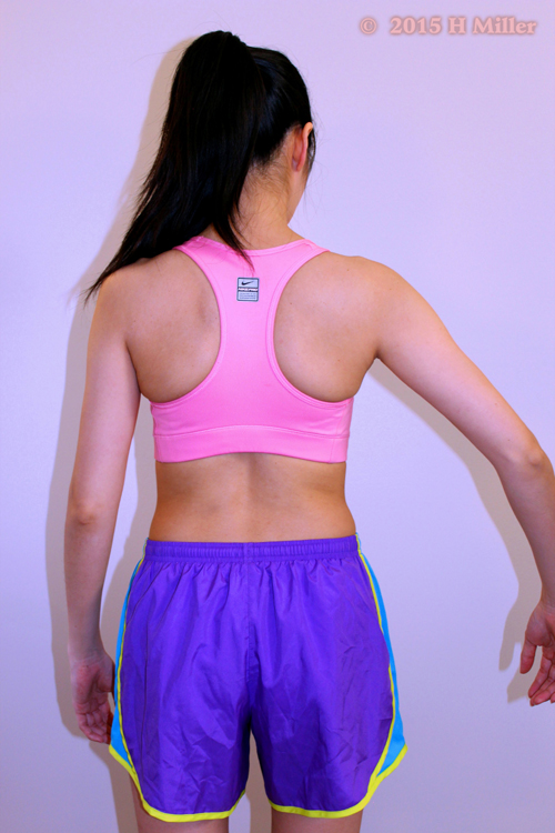 Upward Rotation of the Scapula  Middle Pose