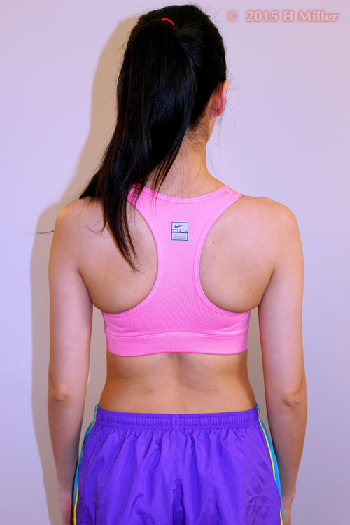 Upward Rotation of the Scapula Starting Pose