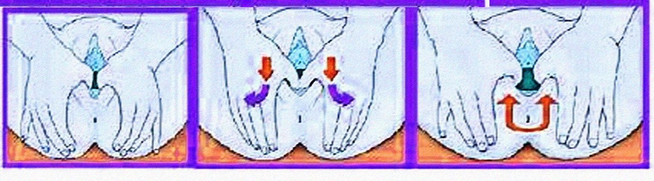 Oxford Perineal-Massage